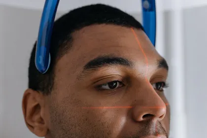Patient undergoing a CBCT cone beam CT scan — an essential diagnostic step before any All-on-6 implant treatment plan