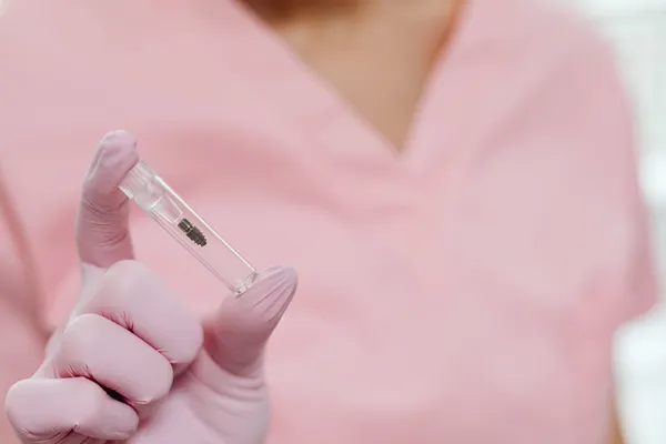 Titanium dental implant post — the core component of All-on-6 full arch implant treatment, available with premium brands at Turkish clinics