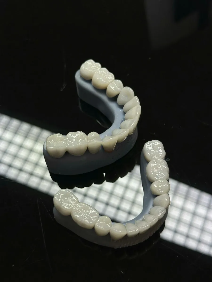 Porcelain veneer shells laid out before bonding — the premium ceramic material used for dental veneers in Turkey and the UK