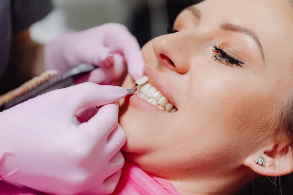 Dental veneer application procedure showing porcelain veneer placement on front teeth — cosmetic dentistry available in Turkey at a fraction of UK prices